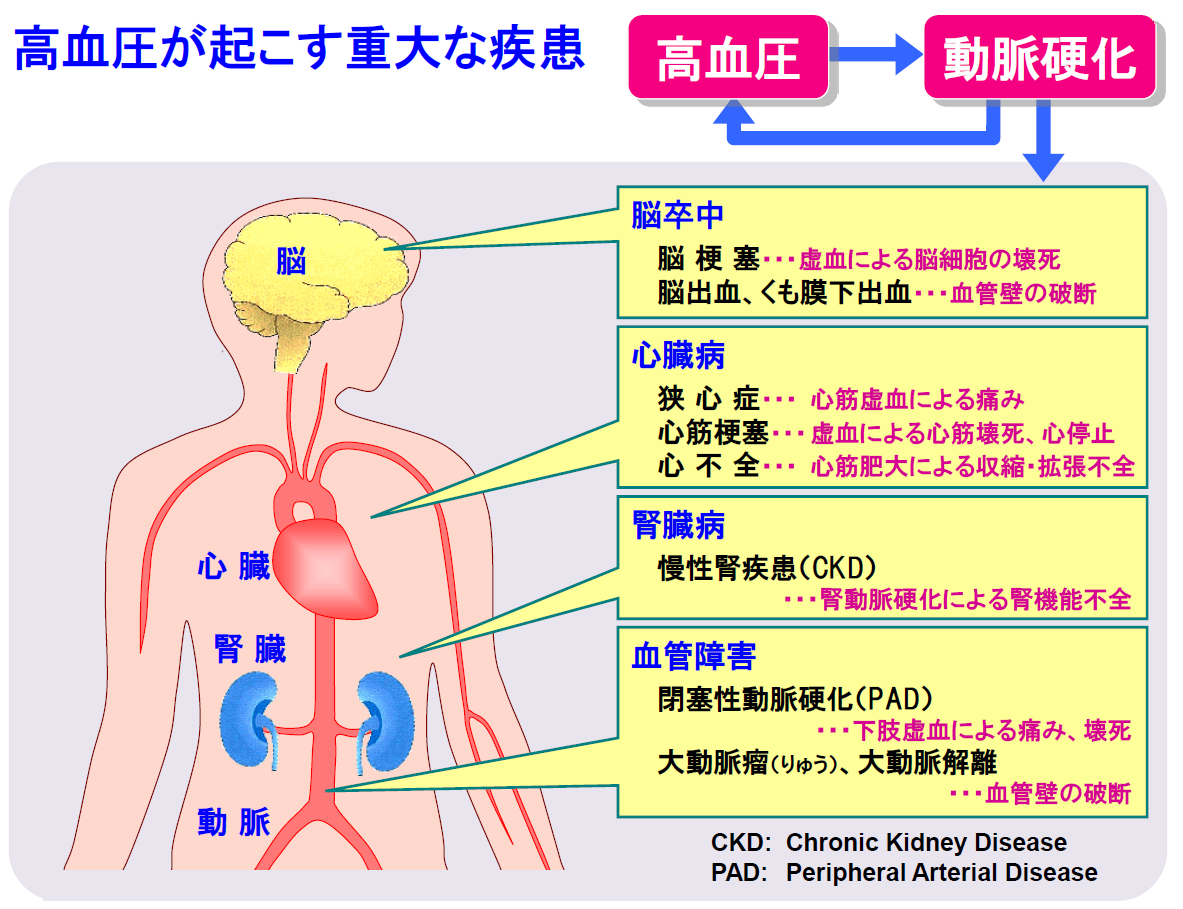 日本高血圧学会